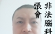 非法腦科研受害者張會