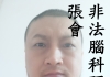 非法腦科研受害者張會