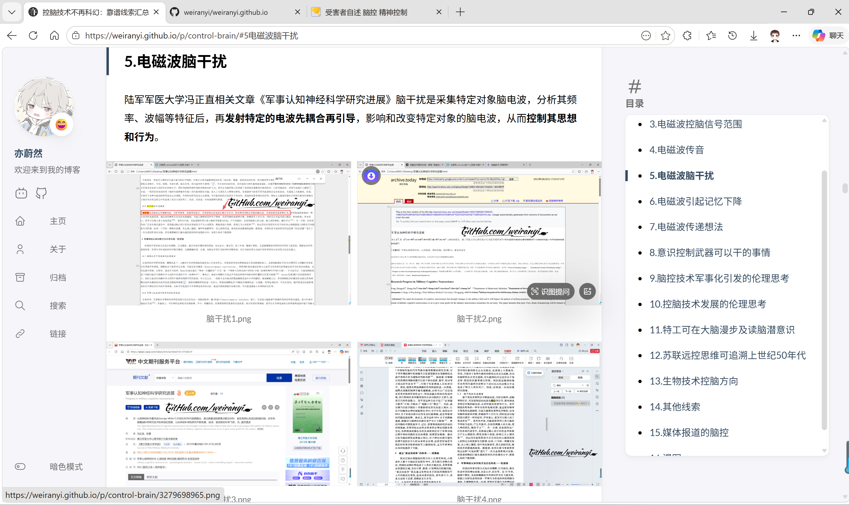 脑干扰.png
