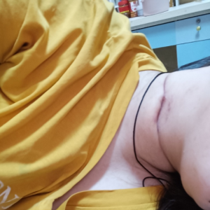 脑控受害者王金玲