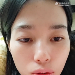 广西脑控受害者 苏美晨《视频》