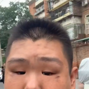 脑控受害者 陈雅鹏《视频》