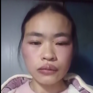 脑控受害者 熊露《视频》