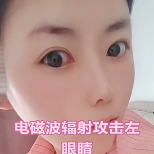 脑控受害者 兰姐《视频》